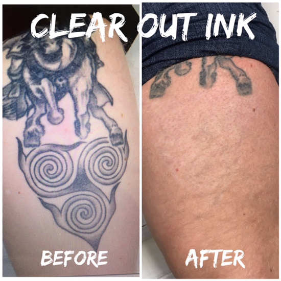 Allegory Premium Tattoo Ink — White — 4oz Bottle - Bleeding Ink Tattoo  Supply